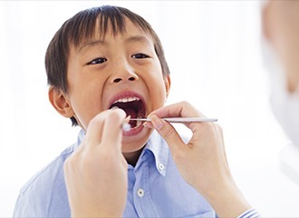 小児矯正について